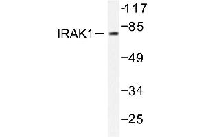 Image no. 1 for anti-Interleukin-1 Receptor-Associated Kinase 1 (IRAK1) antibody (ABIN272026) (IRAK1 antibody)