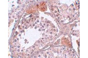 Immunohistochemical staining of human testis tissue with 5 ug/mL C4 or f35 polyclonal antibody .