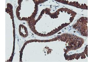 Immunohistochemical staining of paraffin-embedded Human breast tissue using anti-C20orf3 mouse monoclonal antibody. (APMAP antibody)