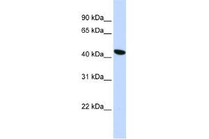 WB Suggested Anti-TMEM117 Antibody Titration:  0. (TMEM117 antibody  (Middle Region))