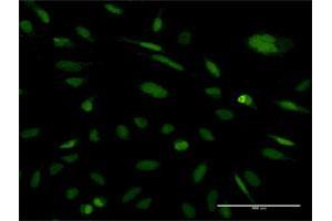 Immunofluorescence of monoclonal antibody to EXOSC5 on HeLa cell. (EXOSC5 antibody  (AA 1-235))