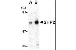 Western blot analysis of SHP2 in mouse skeletal muscle tissue lysate with this product at (A) 0. (PTPN11 antibody  (N-Term))