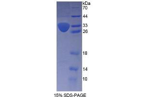 SDS-PAGE analysis of Human KTN1 Protein. (KTN1 Protein)