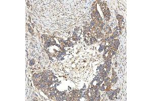 IHC analysis of SNPH using anti-SNPH antibody (ABIN7601724). (Syntaphilin antibody  (AA 43-482))