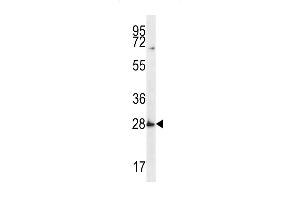 SYPL1 Antibody (N-term) (ABIN656672 and ABIN2845911) western blot analysis in MDA-M cell line lysates (35 μg/lane). (SYPL1 antibody  (N-Term))