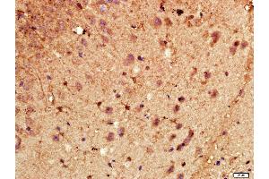 Paraformaldehyde-fixed, paraffin embedded Mouse brain, Antigen retrieval by boiling in sodium citrate buffer (pH6. (CYP46A1 antibody  (AA 51-150))