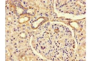 Immunohistochemistry of paraffin-embedded human kidney tissue using ABIN7163181 at dilution of 1:100 (PREX2 antibody  (AA 1417-1592))