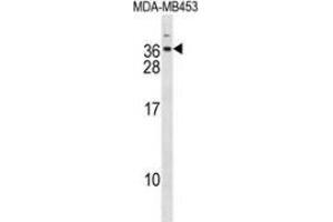 Western blot analysis in MDA-MB453 cell line lysates (35ug/lane) using DLX6  Antibody . (DLX6 antibody  (Middle Region))
