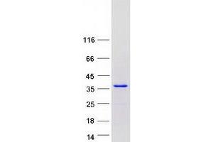 Western Blotting (WB) image for SET Binding Protein 1 (SETBP1) (Transcript Variant 2) protein (Myc-DYKDDDDK Tag) (ABIN2731862)