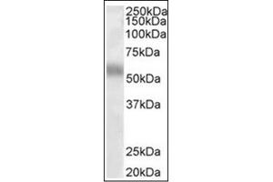 Image no. 1 for anti-Transcription Factor EB (TFEB) (Internal Region) antibody (ABIN374974) (TFEB antibody  (Internal Region))