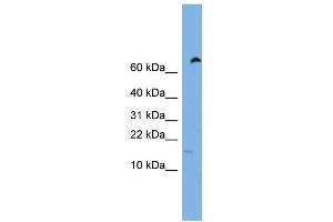 WB Suggested Anti-IFITM5 Antibody Titration:  0.