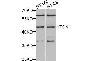 Western blot analysis of extracts of various cell lines, using TCN1 antibody. (TCN1 antibody)