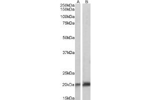Western Blotting (WB) image for anti-Caveolin 3 (CAV3) antibody (ABIN5859803) (Caveolin 3 antibody)