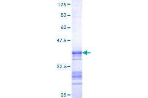 Image no. 1 for Somatostatin (SST) (AA 26-116) protein (GST tag) (ABIN1321432) (Somatostatin Protein (SST) (AA 26-116) (GST tag))