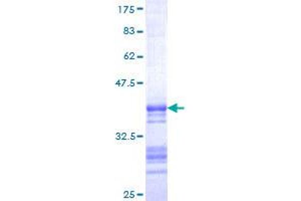 Somatostatin Protein (SST) (AA 26-116) (GST tag)