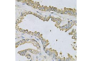 Immunohistochemistry of paraffin-embedded human prostate using APRT Antibody. (APRT antibody  (AA 1-180))