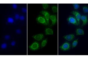 Detection of SDHA in Human Hela cell using Polyclonal Antibody to Succinate Dehydrogenase Complex Subunit A (SDHA) (SDHA antibody  (AA 4-300))