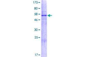 Image no. 1 for Ribosomal Modification Protein RimK-Like Family Member B (RIMKLB) (AA 1-307) protein (GST tag) (ABIN1318077) (RIMKLB Protein (AA 1-307) (GST tag))