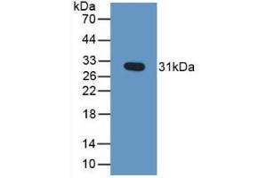 Detection of Recombinant GZMB, Human using Polyclonal Antibody to Granzyme B (GZMB) (GZMB antibody  (AA 21-247))