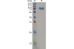 SDS-PAGE (SDS) image for Poliovirus Receptor-Related 2 (Herpesvirus Entry Mediator B) (PVRL2) (AA 32-360) protein (mFc Tag) (ABIN7092735)