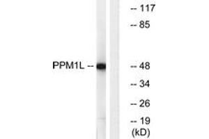 Western blot analysis of extracts from Jurkat cells, using PPM1L Antibody.