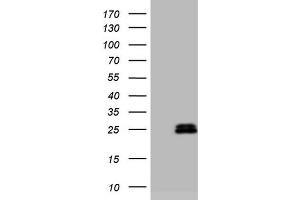 Western Blotting (WB) image for anti-Amelotin (AMTN) antibody (ABIN2716038)