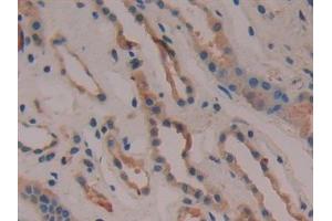 Immunohistochemistry (IHC) image for anti-Cytochrome C Oxidase Subunit II (COX2) (AA 187-425) antibody (ABIN7432421)