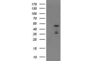 HEK293T cells were transfected with the pCMV6-ENTRY control (Left lane) or pCMV6-ENTRY ELK3 (Right lane) cDNA for 48 hrs and lysed. (ELK3 antibody)