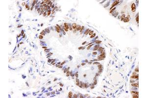 Immunohistochemistry (IHC) image for anti-A Kinase (PRKA) Anchor Protein 8-Like (AKAP8L) (AA 596-646) antibody (ABIN7454742)