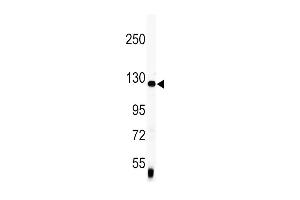 Western blot analysis of anti-Vinculin Antibody (C-term) (ABIN391626 and ABIN2841546) in mouse lung tissue lysates (35 μg/lane). (Vinculin antibody  (C-Term))