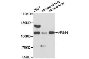 Western blot analysis of extracts of various cell lines, using VPS54 antibody (ABIN6293850) at 1:3000 dilution.