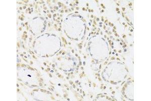 Immunohistochemistry (Paraffin-embedded Sections) (IHC (p)) image for anti-Small Nuclear Ribonucleoprotein Polypeptide A (SNRPA) antibody (ABIN7262230)