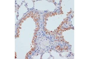 Immunohistochemistry of paraffin-embedded rat liver using SLC39 antibody (ABIN1682781, ABIN3017803, ABIN3017805 and ABIN6220263) at dilution of 1:100 (40x lens). (SLC39A4 antibody  (AA 23-327))