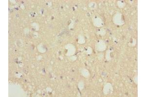 Immunohistochemistry of paraffin-embedded human brain tissue using ABIN7164431 at dilution of 1:100 (HERC6 antibody  (AA 764-1022))