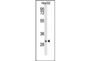 Western blot analysis of DIO3 Antibody (C-term) in HepG2 cell line lysates (35ug/lane). (DIO3 antibody  (C-Term))