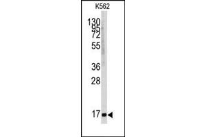 Image no. 1 for anti-Microsomal Glutathione S-Transferase 1 (MGST1) (Center) antibody (ABIN357900) (MGST1 antibody  (Center))