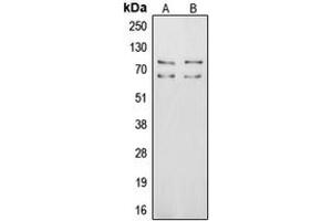 Western blot analysis of Vitronectin expression in MCF7 (A), HepG2 (B) whole cell lysates. (Vitronectin antibody  (Center))