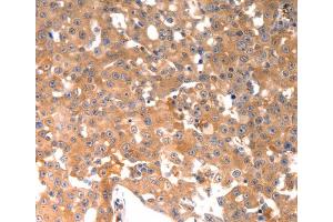 Immunohistochemistry (IHC) image for anti-Osteocalcin (BGLAP) antibody (ABIN2425622) (Osteocalcin antibody)