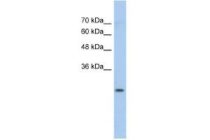 GSTM1 antibody used at 1 ug/ml to detect target protein. (GSTM1 antibody  (N-Term))