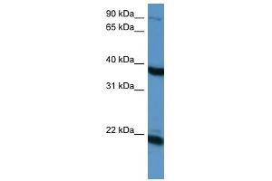 Pleiotrophin antibody used at 1 ug/ml to detect target protein.