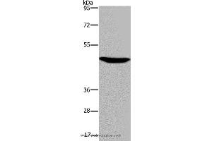Western blot analysis of Mouse brain tissue, using P2RX2 Polyclonal Antibody at dilution of 1:300