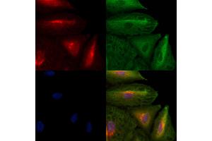 ABIN6259273 and ABIN6273655 staining  cells by IF/ICC. (FIL1h antibody  (C-Term))