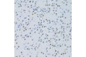 Immunohistochemistry of paraffin-embedded rat pancreas using SNRNP70 antibody. (SNRNP70 antibody  (AA 150-250))