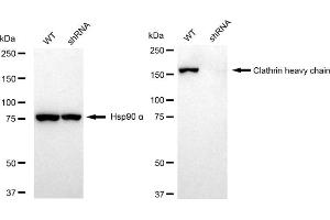 Western blotting analysis using Clathrin heavy chain antibody (ABIN7798090). (Recombinant Clathrin Heavy Chain (CLTC) antibody)