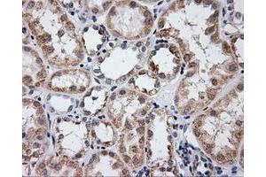Immunohistochemical staining of paraffin-embedded liver tissue using anti-LIPG mouse monoclonal antibody. (LIPG antibody)
