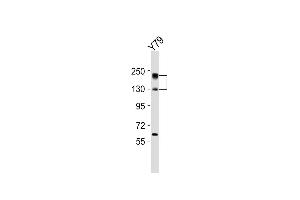 Anti-NOS2A Antibody (Center)at 1:2000 dilution + Y79 whole cell lysates Lysates/proteins at 20 μg per lane. (NOS2 antibody  (AA 830-860))