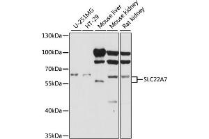 Western blot analysis of extracts of various cell lines, using SLC22 antibody (ABIN7270421) at 1:1000 dilution. (SLC22A7 antibody  (AA 50-142))