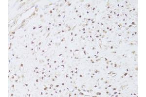 Immunohistochemistry of paraffin-embedded human leiomyoma of uterus using FKBP4 Antibody (ABIN5973289) at dilution of 1/100 (40x lens). (FKBP4 antibody)