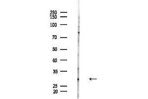 anti-Chibby Homolog 1 (CBY1) (N-Term) antibody