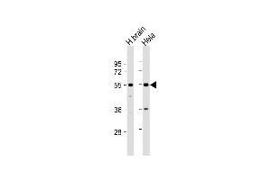 All lanes : Anti-TFG Antibody (Center) at 1:1000 dilution Lane 1: human brain lysate Lane 2: Hela whole cell lysate Lysates/proteins at 20 μg per lane. (TFG antibody  (AA 85-114))